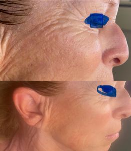 Lynn Roscioli Aesthetics photo 4