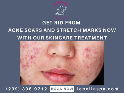 Le Bella Spa photo 31