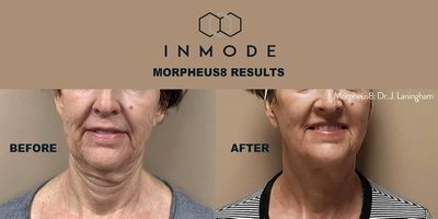 Le Bella Spa photo 35