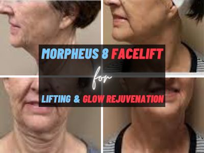 Le Bella Spa photo 39