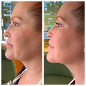 Le Bella Spa photo 44