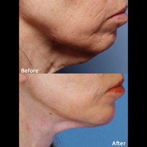 Le Bella Spa photo 47