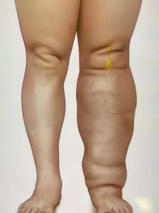 Detox Massage(Asia) photo 11