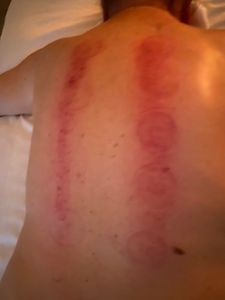 Detox Massage(Asia) photo 40