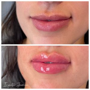 Meridian Medical Spa