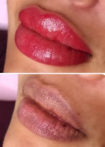 Principessa Med Spa photo 49