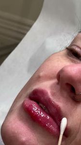 The Monarch MedSpa LLC photo 4