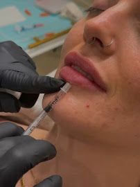 The Monarch MedSpa LLC photo 10