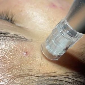 Skin Radiance Med Spa photo 38