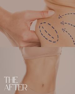 BodySculptMD™ photo 3