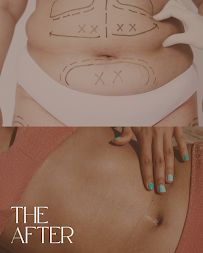 BodySculptMD™ photo 4