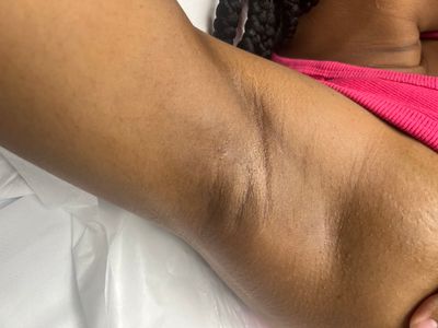 Skin Deep Beauty Studio – Brazilian Waxing Brandon photo 21