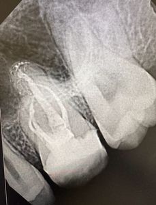 Endothetics Tampa Endodontics & IV Sedation Dentistry photo 9