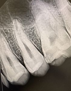 Endothetics Tampa Endodontics & IV Sedation Dentistry photo 28