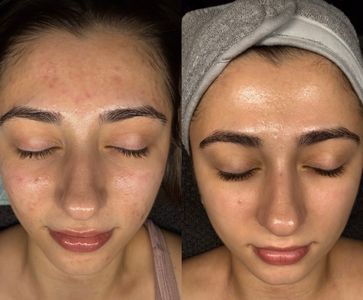 NC Aesthetics Facial Studio photo 3