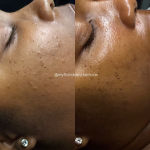 NC Aesthetics Facial Studio photo 6