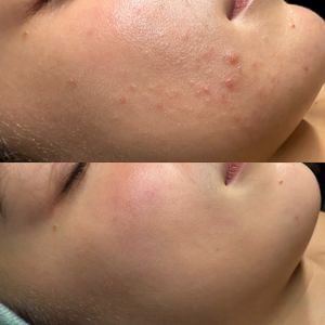 NC Aesthetics Facial Studio photo 8