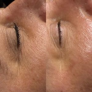 NC Aesthetics Facial Studio photo 9