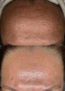 NC Aesthetics Facial Studio photo 10