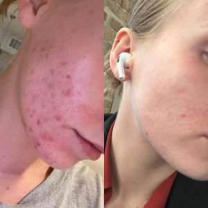 NC Aesthetics Facial Studio photo 11