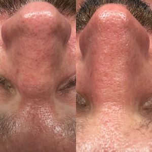 NC Aesthetics Facial Studio photo 20