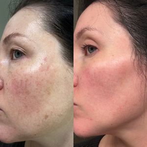 NC Aesthetics Facial Studio photo 27