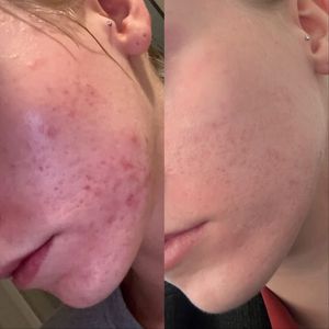 NC Aesthetics Facial Studio photo 30