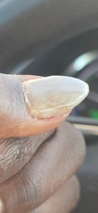 X Nails Bar photo 32