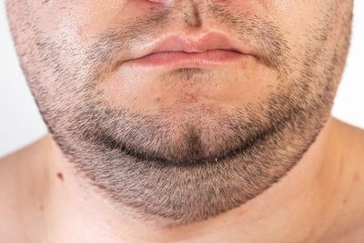 Unique Dermatology & Wellness Center: Dr Dyan J Harvey, DO photo 24