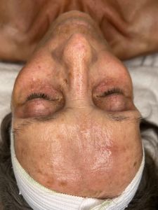 NBS Esthetics photo 13