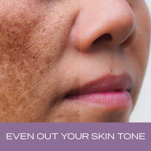 NBS Esthetics photo 32