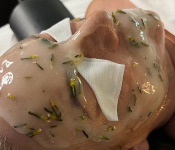 NBS Esthetics photo 36