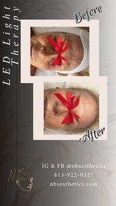 NBS Esthetics photo 38