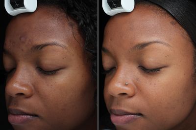 Skin Science photo 42