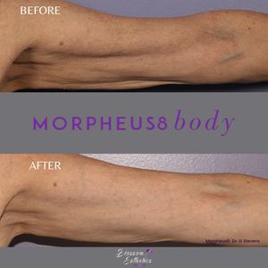 Blossom Esthetics Med Spa photo 38