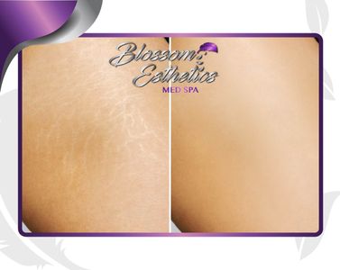 Blossom Esthetics Med Spa photo 39