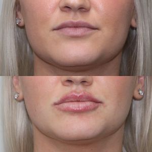 The Aesthetics Lounge and Spa Venice photo 16