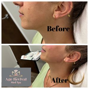 Age Revival Med Spa photo 27