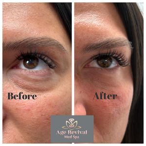 Age Revival Med Spa photo 28