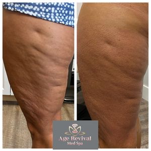 Age Revival Med Spa photo 29