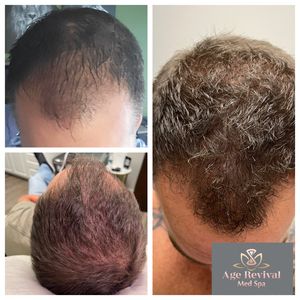 Age Revival Med Spa photo 32