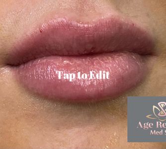 Age Revival Med Spa photo 33