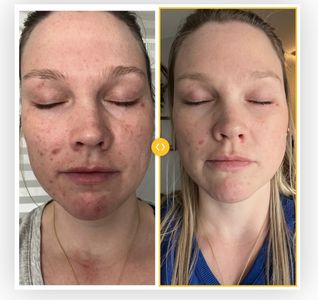 Age Revival Med Spa photo 35