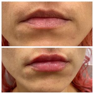 Age Revival Med Spa photo 36