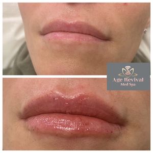 Age Revival Med Spa photo 37