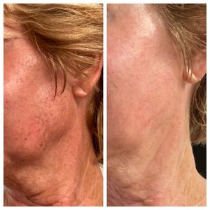 Age Revival Med Spa photo 38