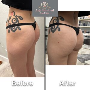 Age Revival Med Spa photo 40