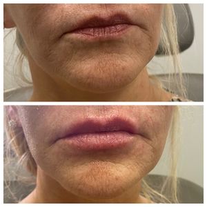 Age Revival Med Spa photo 42