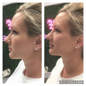 Age Revival Med Spa photo 43