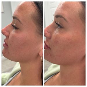 Age Revival Med Spa photo 44